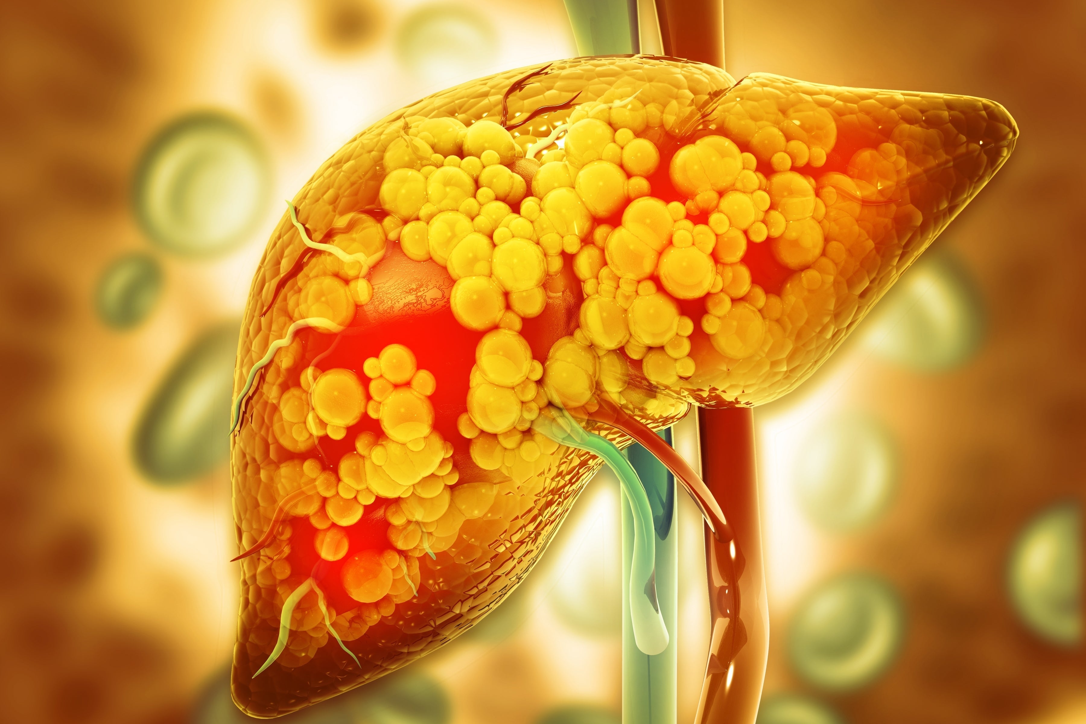 The Hidden Danger Of Abdominal Pain: Liver Enlargement Revealed - 55zzgy1