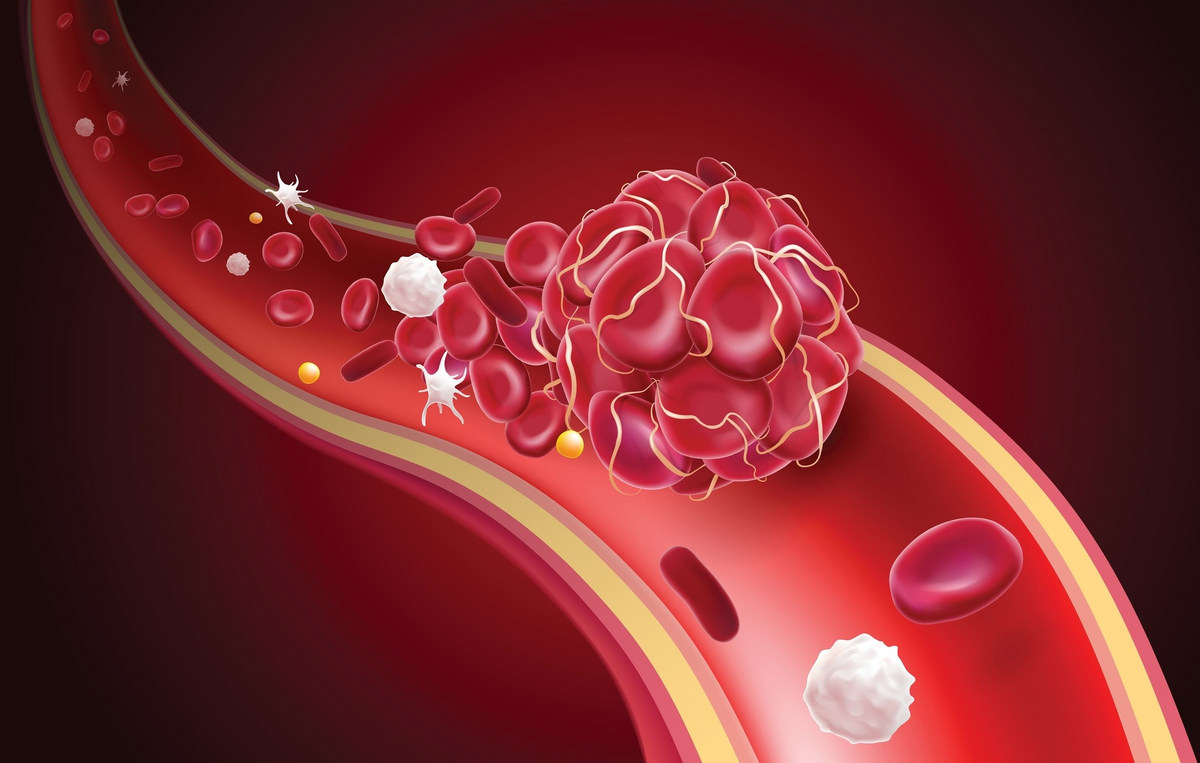 Unveiling the Silent Killers of High Cholesterol: How InnerThera Bergamot Heart Offers a Solution