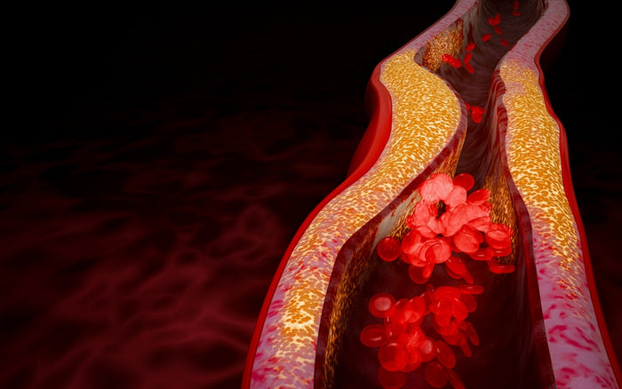 Lower Cholesterol Naturally: 2 Simple Strategies for Heart Health